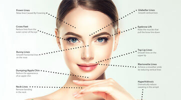 Dysport Vs. Botox: What’s the Difference?