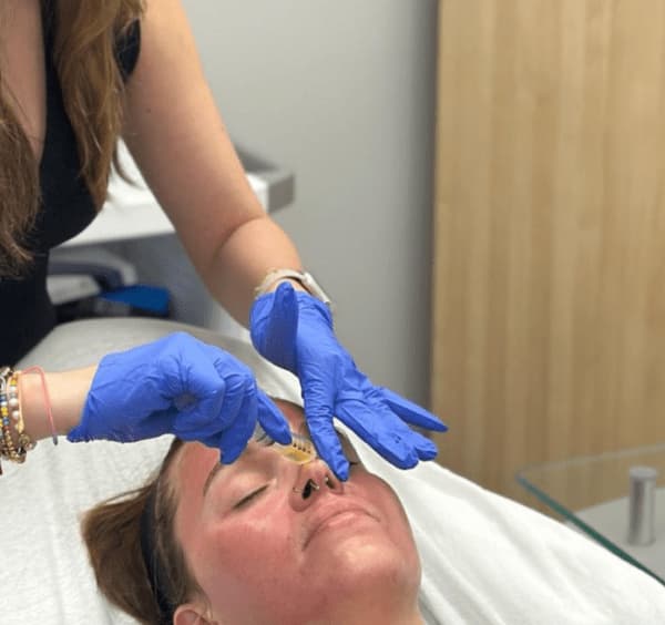 Vampire Facial Vampire Facial