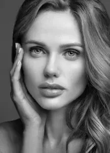 Lip Fillers-Ashland, OR-Illume Aesthetics A beautiful woman with plump lips from fillers at Illume Aesthetics in Ashland, OR.