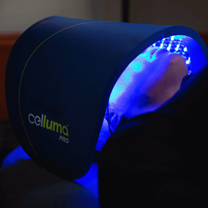 Illume Aesthetics Ashland OR home facial rejuvenation