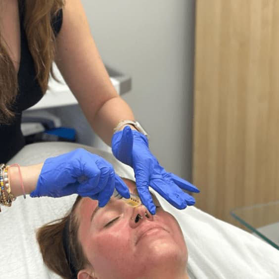 Illume Aesthetics Ashland OR vampire facial