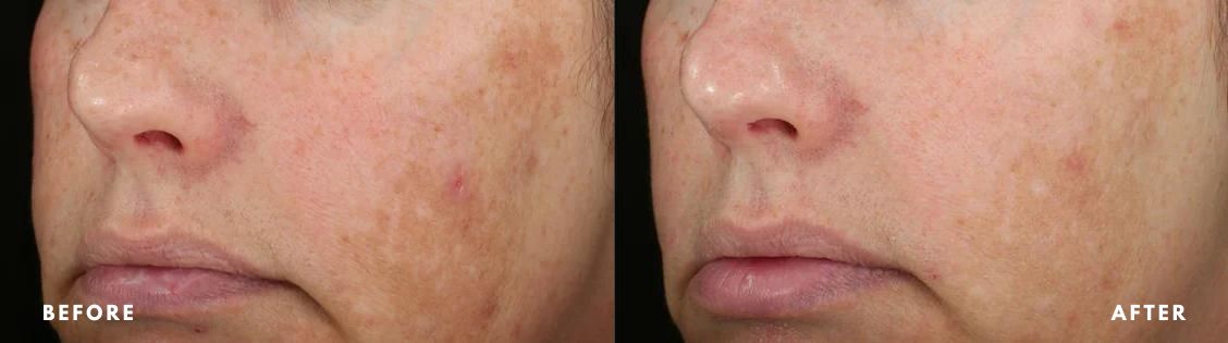 xr:d:DAFg N h Ys: j: t: xr:d:DAFg N h Ys: j: t: