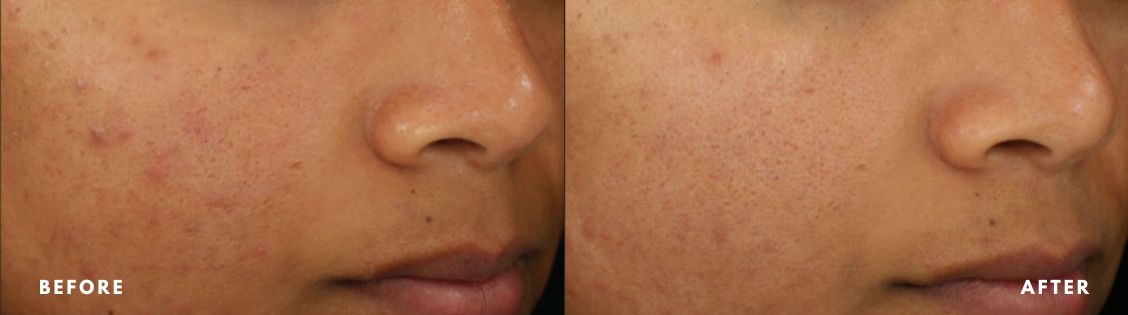 Diamond Glow Facial – Copy Diamond Glow Facial - Copy