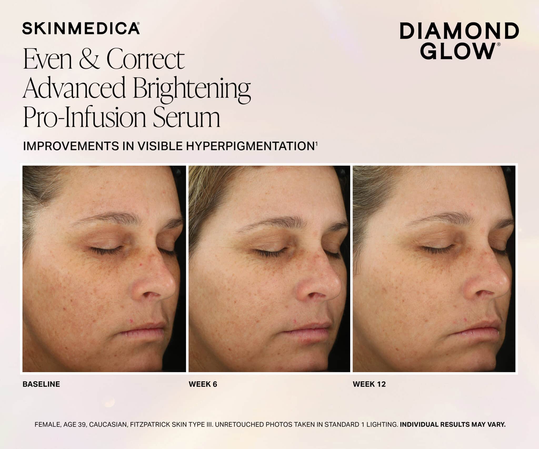 DiamondGlow facial before and after — skin texture, tone, and clarity improvement