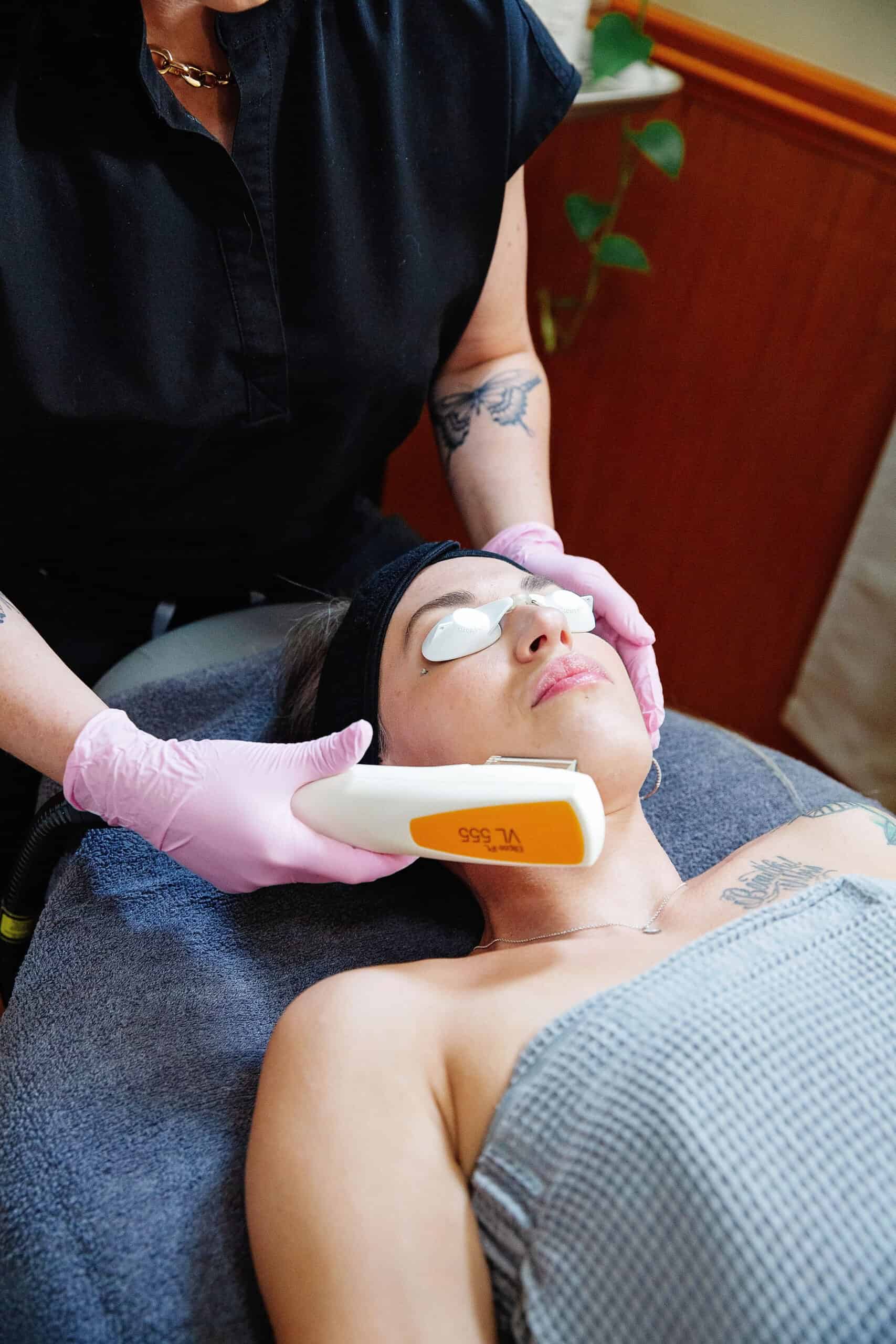 IPL photofacial treatment at Illume Aesthetics — intense pulsed light for sun damage and redness correction