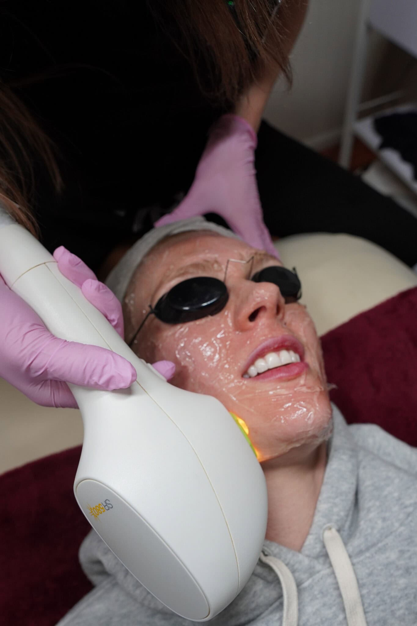 Patient smiling during laser treatment at Illume Aesthetics